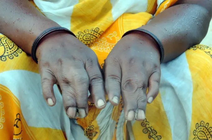 The untold story of Jaduguda: The country's nuclear power became the tragedy of a village