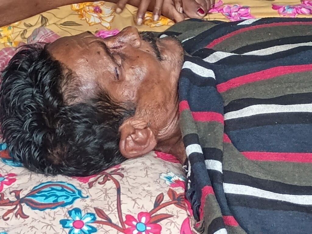 Sensation in Pakur: Drunken Son Murders Father with a Sickle, Sat Beside the Body All Night